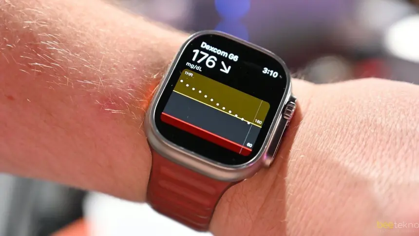 Dexcom G7 ile Şeker Takibi Artık Apple Watch'ta!
